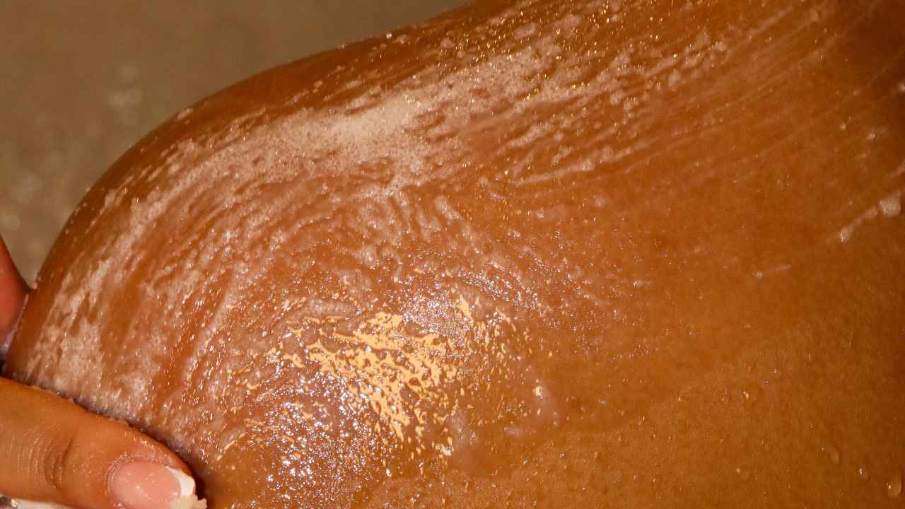 easy hyperpigmentation hacks for a luminous Look