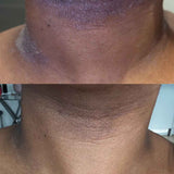 a before and after photo of healed eczema patch after using our hydrating body lotion for dry skin conditions